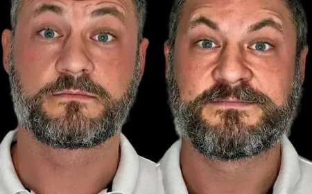 Commence Skin Revival via Profhilo in Dubai