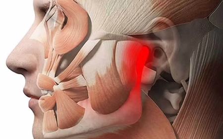 Effective Physio for TMJ Pain and Headaches in Edinburgh