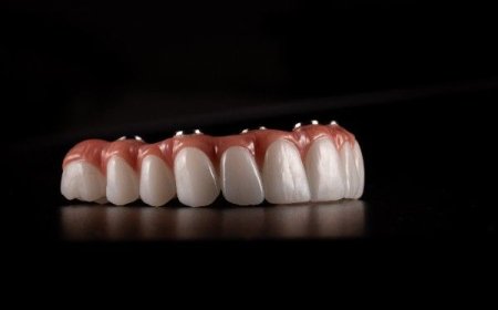 Why Choose Local Smile Care Professionals in Huddersfield