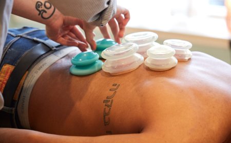 Cupping Therapy in Philadelphia: Timeless Healing, Modern Approach