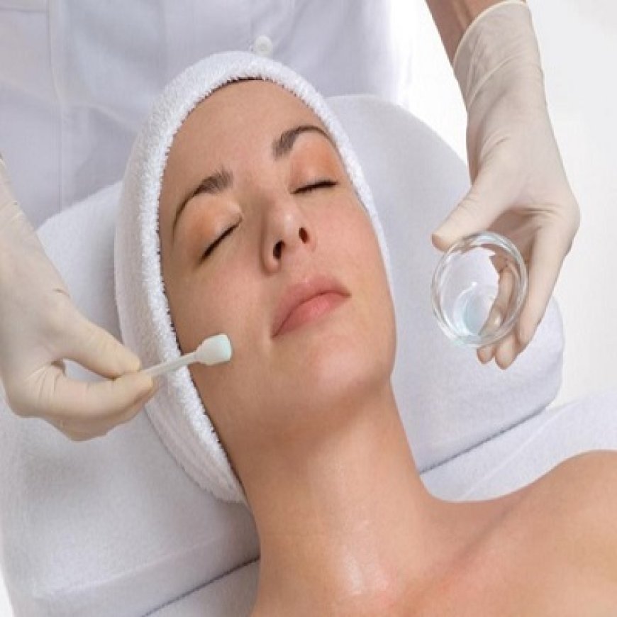 Tired of Uneven Skin? A Chemical Peel Might Be the Perfect Solution