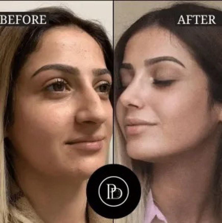 Discover the Future of Aesthetics with PRP Treatment in Dubai