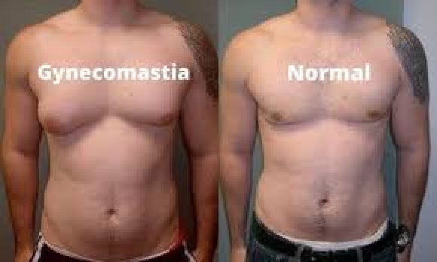 Affordable Options for Male Breast Reduction in Islamabad
