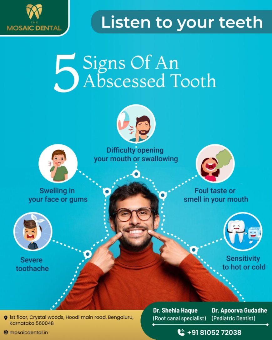 Dental Doctors in Hoodi Bangalore: Your Comprehensive Guide