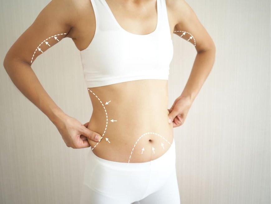 Fat Transfer Surgery in Dubai: Everything You Need to Know
